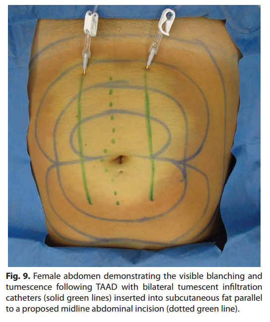 Fig. 9.